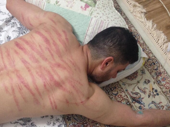 Sorab Abolfathi forteller at han ble slått og mishandlet i iransk fengsel etter å ha blitt kastet ut av Norge. Foto: Privat Sorab Abolfathi forteller at han ble slått og mishandlet i iransk fengsel etter å ha blitt kastet ut av Norge. Foto: Privat
