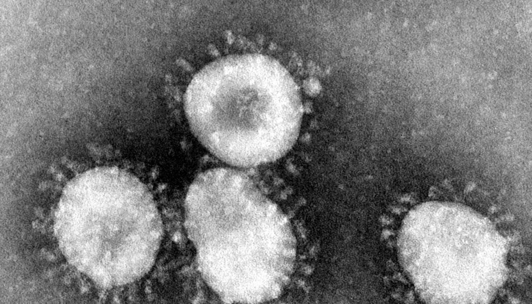 Medisinene det er snakk om, har blitt testet i laboratorium hvor det har vist effekt. Her tidligere generasjoners koronavirus (SARS-viruset) under elektronmikroskop.