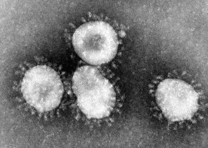 Foto av tidligere generasjoners koronavirus (SARS-viruset) under elektronmikroskop. Foto: Centers for Disease Control and Prevention's Public Health Image Library / Wikipedia