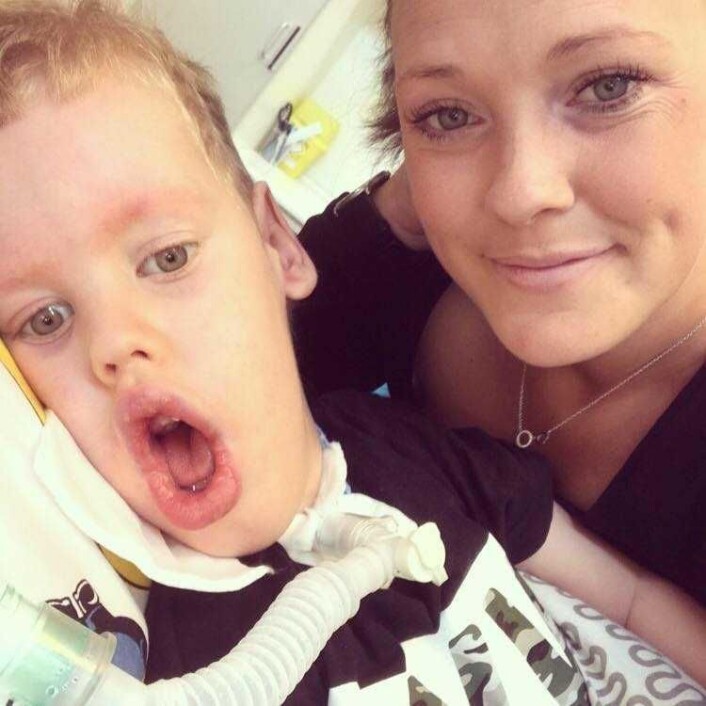 På halsen ser du luftslangen fra pustemaskinen William må være tilkoble hele tiden. — Han må ha tilsyn døgnet rundt, påpeker mor Elin Gunnarsson. Foto: Privat På halsen ser du luftslangen fra pustemaskinen William må være tilkoble hele tiden. — Han må ha tilsyn døgnet rundt, påpeker mor Elin Gunnarsson. Foto: Privat