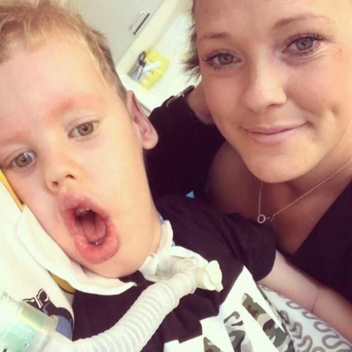 På halsen ser du luftslangen fra pustemaskinen William må være tilkoble hele tiden. — Han må ha tilsyn døgnet rundt, påpeker mor Elin Gunnarsson. Foto: Privat På halsen ser du luftslangen fra pustemaskinen William må være tilkoble hele tiden. — Han må ha tilsyn døgnet rundt, påpeker mor Elin Gunnarsson. Foto: Privat