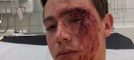 22 år gamle Edvin Eriksen ble skallet ned i sentrum på grunn av legningen sin 22 år gamle Edvin Eriksen ble skallet ned i sentrum på grunn av legningen sin