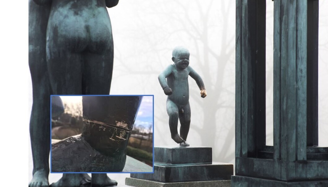 Sinnataggen i Vigelandsparken og sagesporene i beinet. Sinnataggen i Vigelandsparken og sagesporene i beinet.