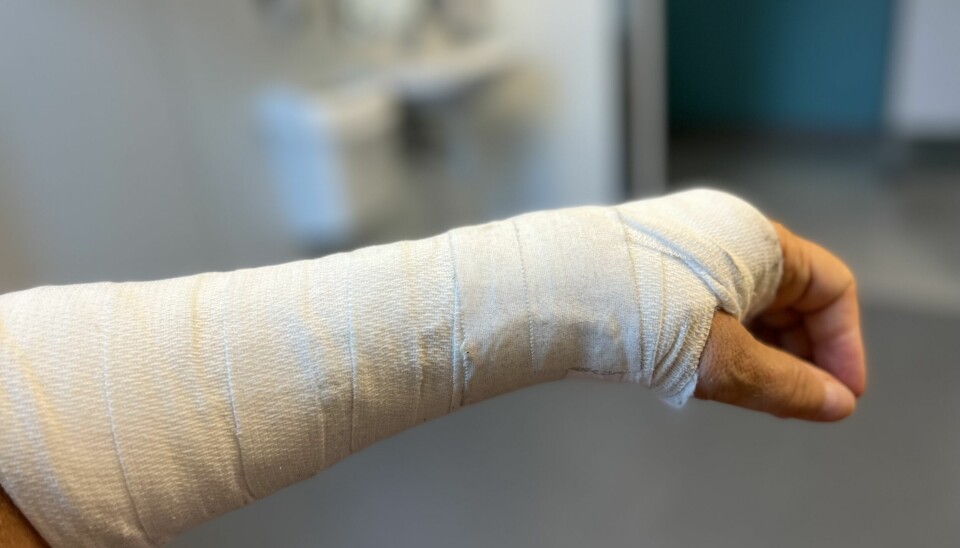Arne Volls gipsede arm etter bruddskade fra fall. Foto: Gjensidige