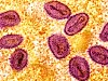 Forstørret bilde av mpox-viruspartikler (rosa) funnet i en infisert celle (gul), dyrket i laboratoriet.