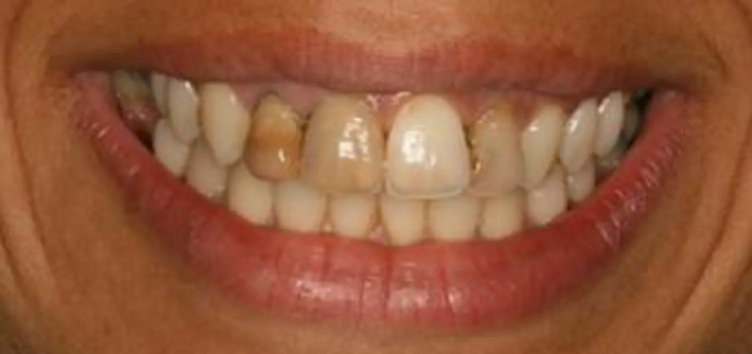 After